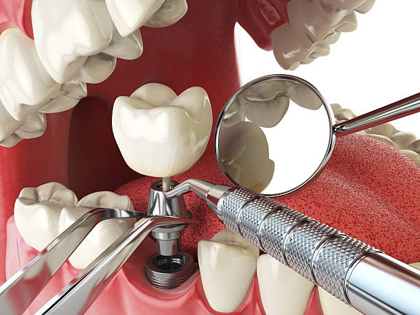 Best Emergency Gum Pain Relief  in Island Lake, IL